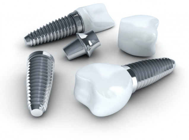 Texas Dental Plano Dental Implants Plano Tx